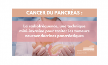 Cancer du pancréas : La radiofréquence, une technique mini-invasive pour traiter les tumeurs neuroendocrines pancréatiques (Institut Paoli-Calmettes)
