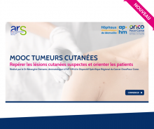 Formation en ligne pour les pros de santé : participez au MOOC TUMEURS CUTANÉES (DSRC OncoPaca-Corse, APHM, ARS Paca)