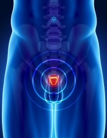 Dépistage individuel des cancers de la prostate : limites, bénéfices, risques